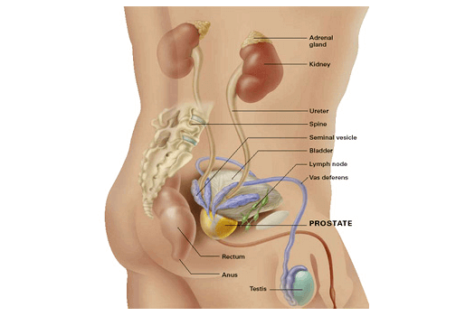 human prostate cancer